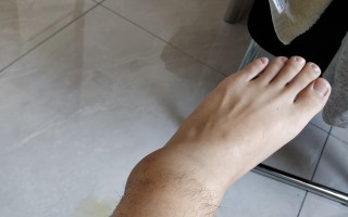 脚踝扭伤后可以踢足球吗，脚踝扭伤一般多久恢复正常