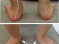 足弓外翻能踢足球吗男生，足弓外翻